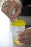 De urine uit de opvangbeker wordt in het A-flesje gegoten