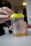 Als de sporter minder dan 90 cc geplast heeft, wordt gebruik gemaakt van de partial sample kit